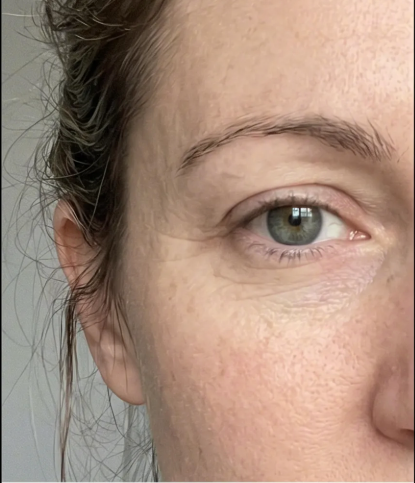 Before image