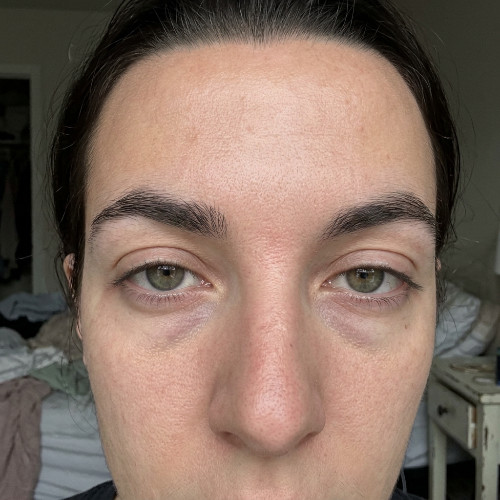 Before image